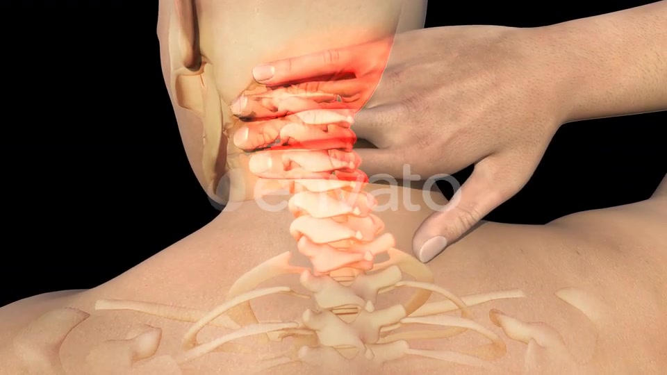 Man With Neck Pain Videohive 22730746 Motion Graphics Image 8