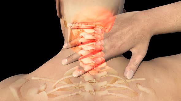 Man With Neck Pain - 22730746 Download Videohive