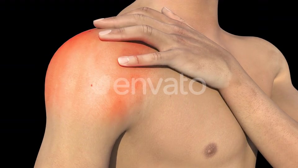 Man With Shoulder Pain Videohive 22720896 Motion Graphics Image 3
