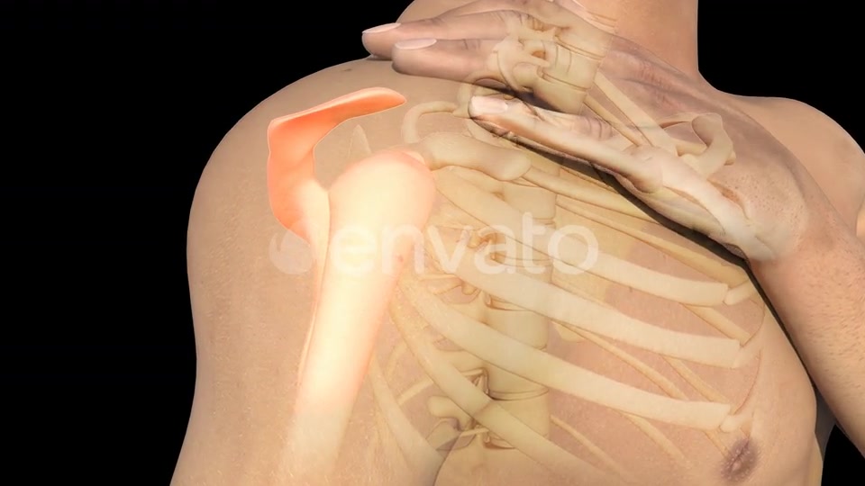 Man With Shoulder Pain Videohive 22720896 Motion Graphics Image 6