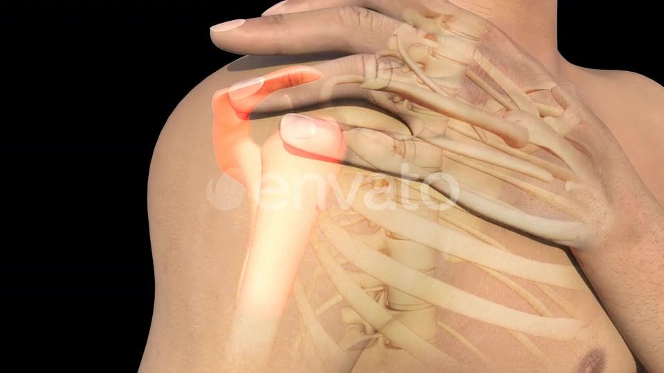 Man With Shoulder Pain Videohive 22720896 Motion Graphics Image 7