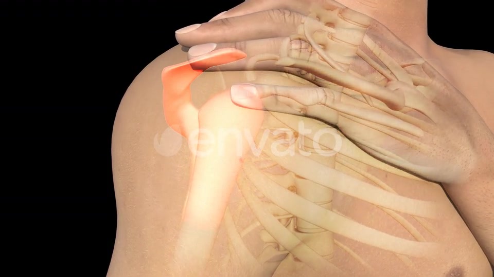 Man With Shoulder Pain Videohive 22720896 Motion Graphics Image 8