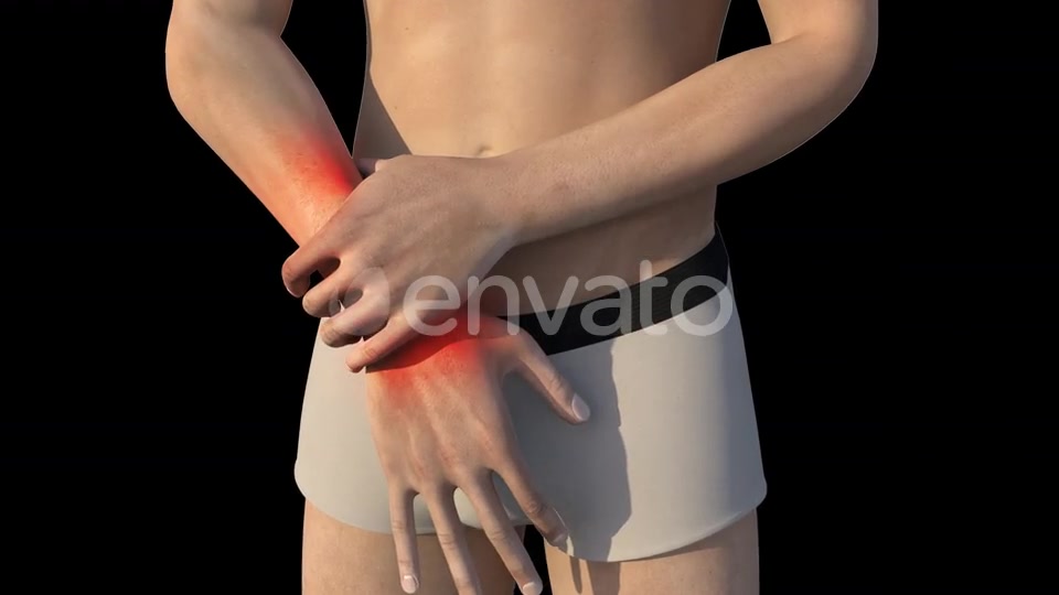 Man With Wrist Pain Videohive 22721884 Motion Graphics Image 3