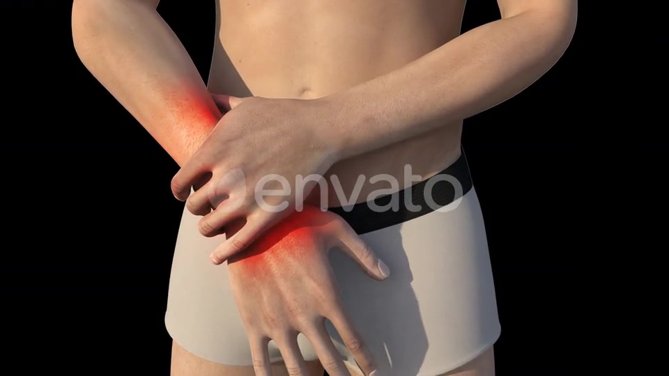 Man With Wrist Pain Videohive 22721884 Motion Graphics Image 4