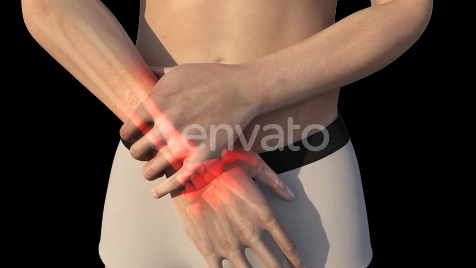 Man With Wrist Pain Videohive 22721884 Motion Graphics Image 5
