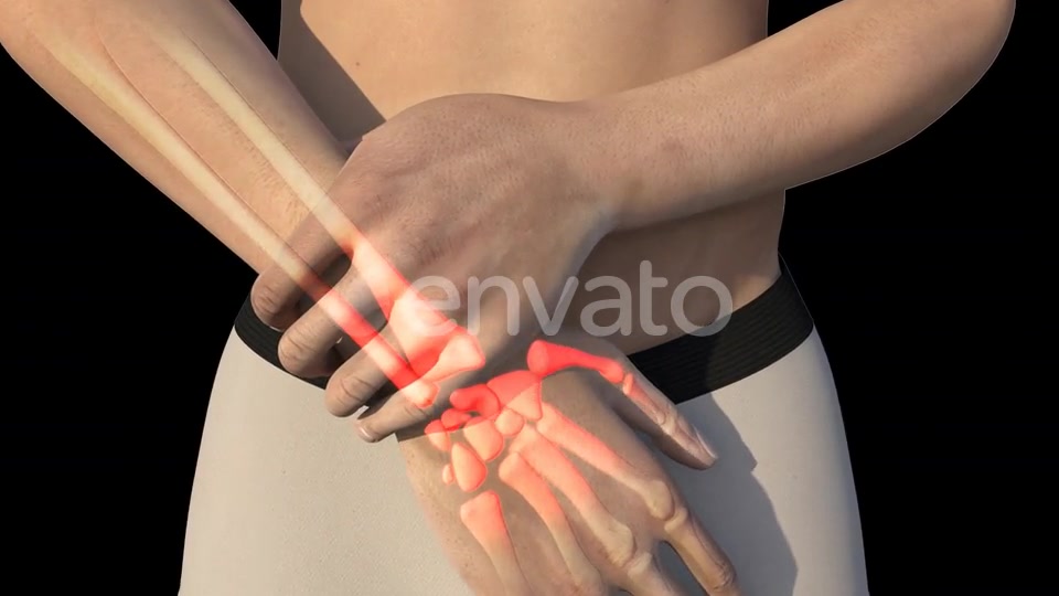 Man With Wrist Pain Videohive 22721884 Motion Graphics Image 6