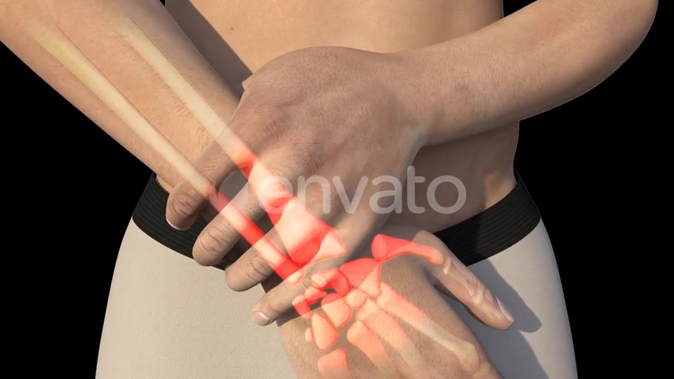 Man With Wrist Pain Videohive 22721884 Motion Graphics Image 7