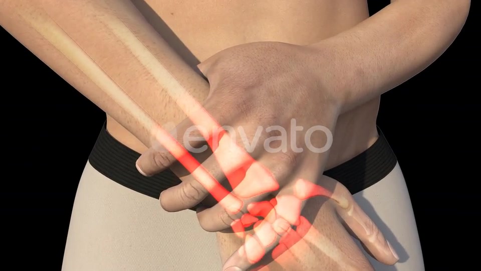 Man With Wrist Pain Videohive 22721884 Motion Graphics Image 8