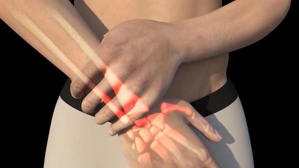 Man With Wrist Pain - 22721884 Videohive Download