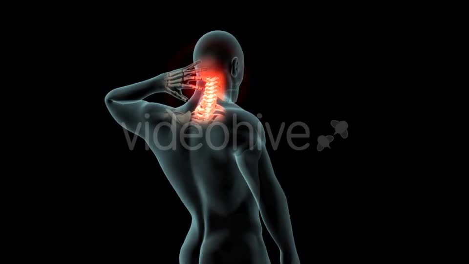 Neck Pain Videohive 21249692 Motion Graphics Image 1