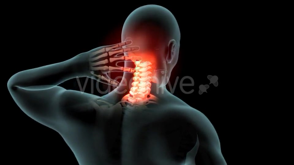 Neck Pain Videohive 21249692 Motion Graphics Image 4