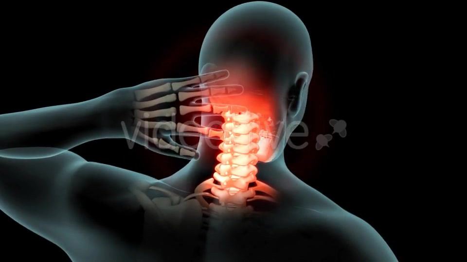 Neck Pain Videohive 21249692 Motion Graphics Image 5