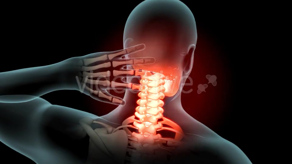 Neck Pain Videohive 21249692 Motion Graphics Image 6