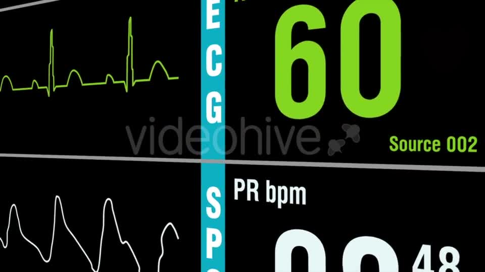 Patient Monitor Displays Medical Exam Vital Signs Videohive 15262317 Motion Graphics Image 1