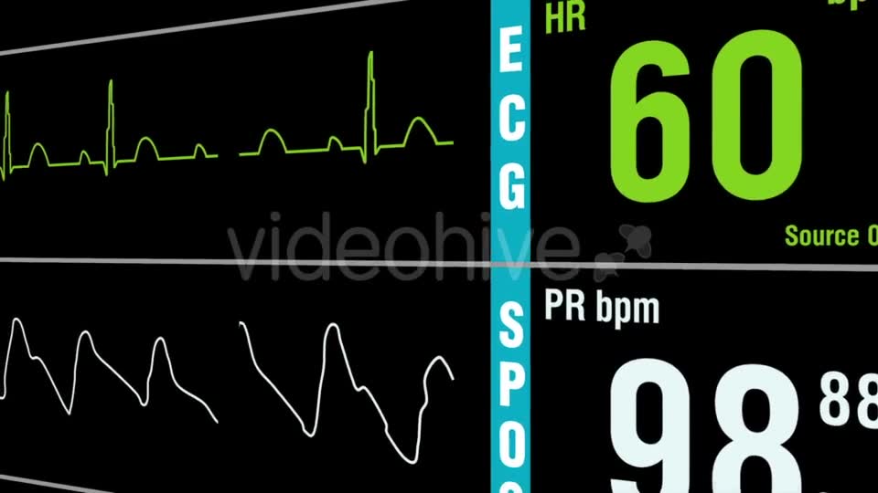 Patient Monitor Displays Medical Exam Vital Signs Videohive 15262317 Motion Graphics Image 2