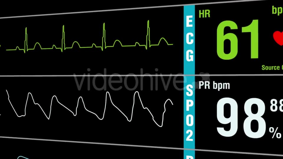 Patient Monitor Displays Medical Exam Vital Signs Videohive 15262317 Motion Graphics Image 3