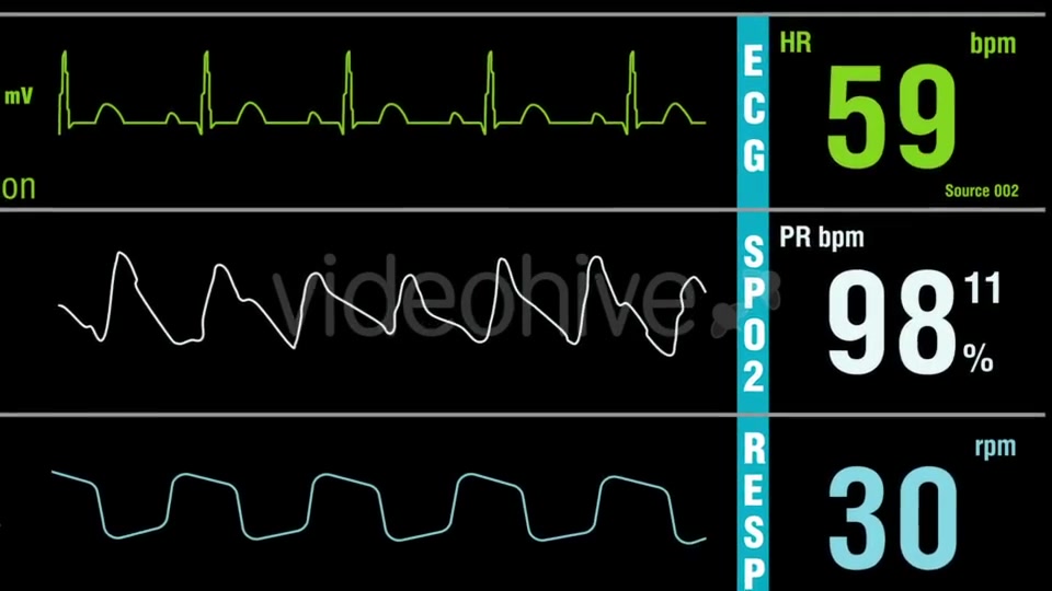 Patient Monitor Displays Medical Exam Vital Signs Videohive 15262317 Motion Graphics Image 5