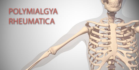 Polymialgya Rheumatica - 16092049 Videohive Download