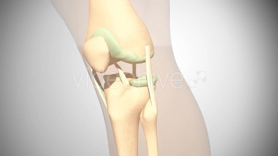 Rupture Of The Anterior Cruciate Ligament Videohive 16097377 Motion Graphics Image 2