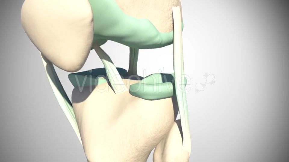 Rupture Of The Anterior Cruciate Ligament Videohive 16097377 Motion Graphics Image 3