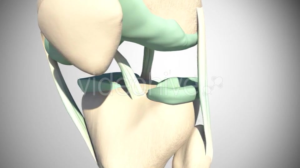 Rupture Of The Anterior Cruciate Ligament Videohive 16097377 Motion Graphics Image 4