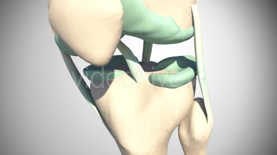 Rupture Of The Anterior Cruciate Ligament Videohive 16097377 Motion Graphics Image 5