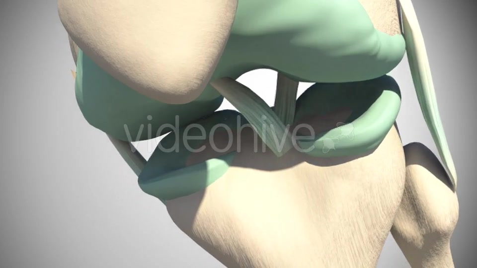 Rupture Of The Anterior Cruciate Ligament Videohive 16097377 Motion Graphics Image 7