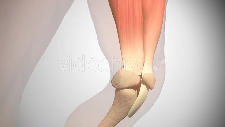 Rupture Of The Quadriceps Tendon Videohive 16093760 Motion Graphics Image 2