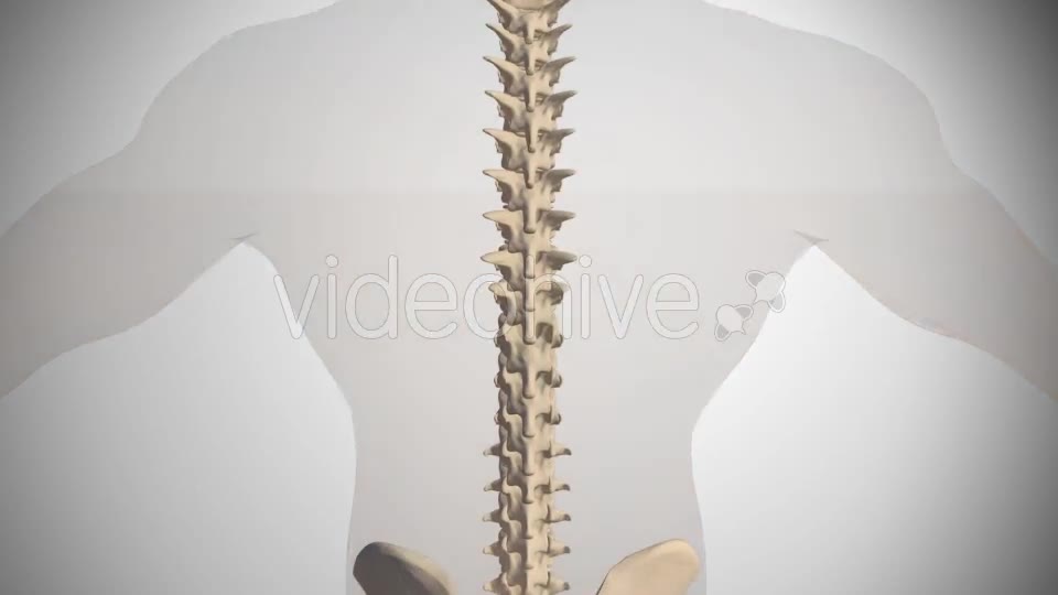 Scoliosis Of The Spine Videohive 14408192 Motion Graphics Image 2