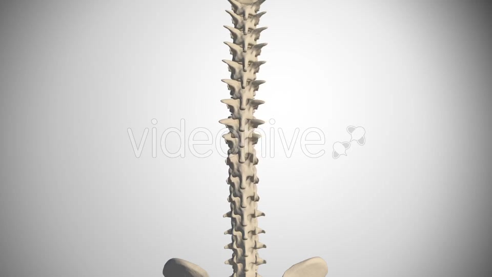 Scoliosis Of The Spine Videohive 14408192 Motion Graphics Image 3