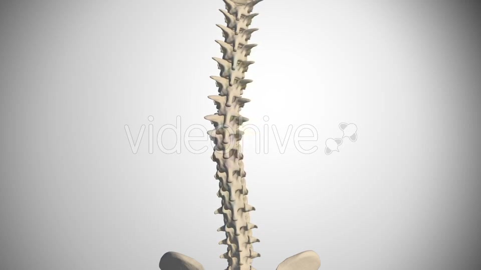 Scoliosis Of The Spine Videohive 14408192 Motion Graphics Image 4