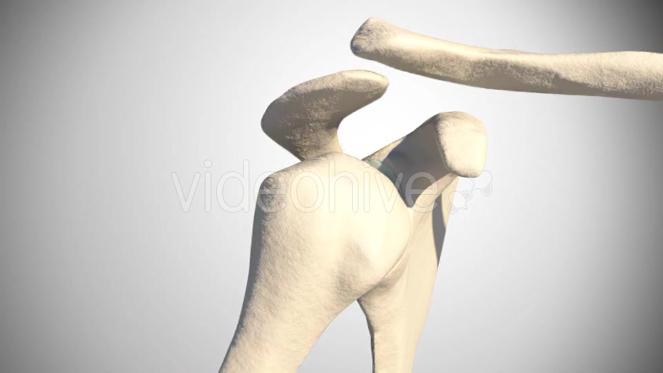 Shoulder Dislocation Videohive 16088265 Motion Graphics Image 8