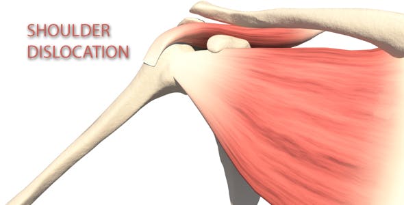 Shoulder Dislocation - Download 16088265 Videohive