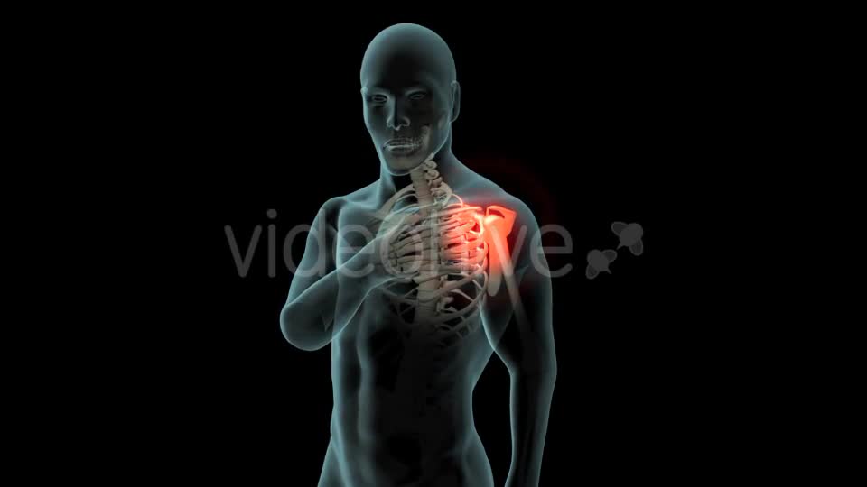 Shoulder Pain Videohive 21251423 Motion Graphics Image 1