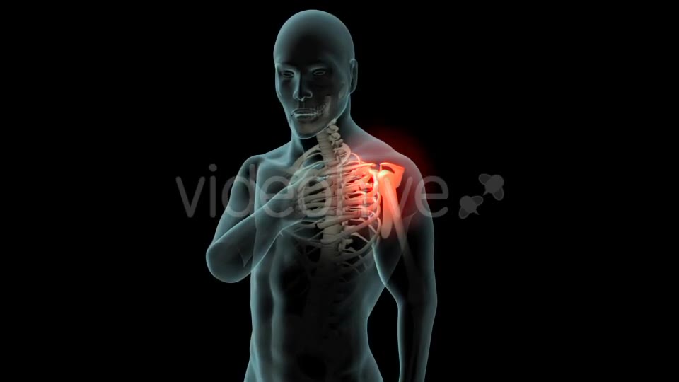 Shoulder Pain Videohive 21251423 Motion Graphics Image 2