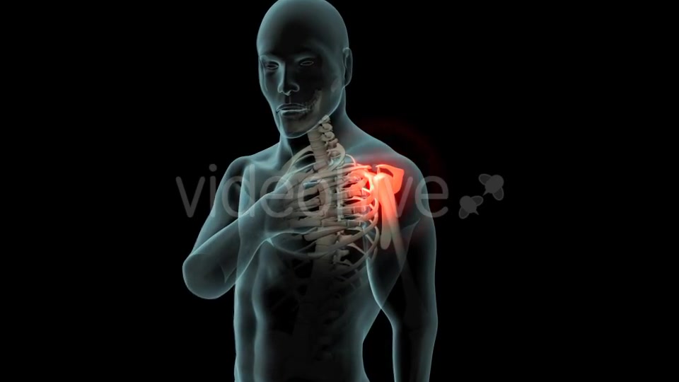 Shoulder Pain Videohive 21251423 Motion Graphics Image 3