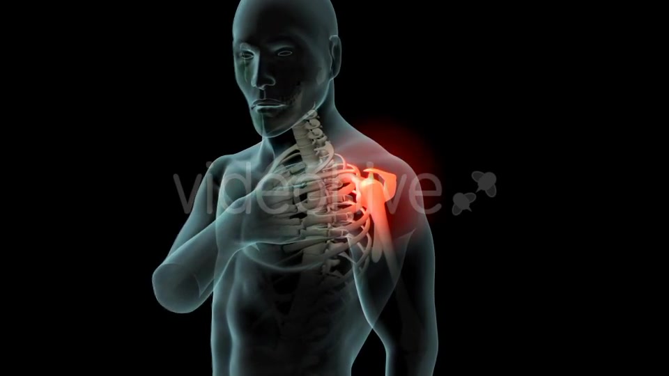 Shoulder Pain Videohive 21251423 Motion Graphics Image 4