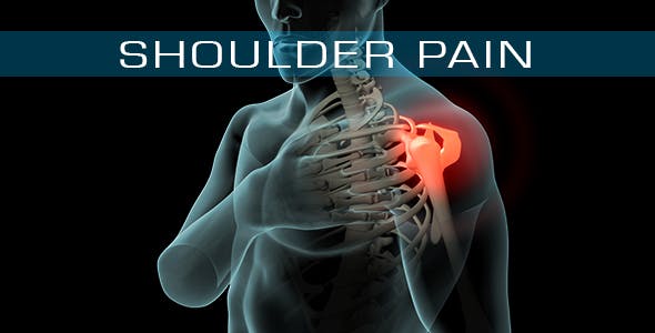 Shoulder Pain - Videohive 21251423 Download