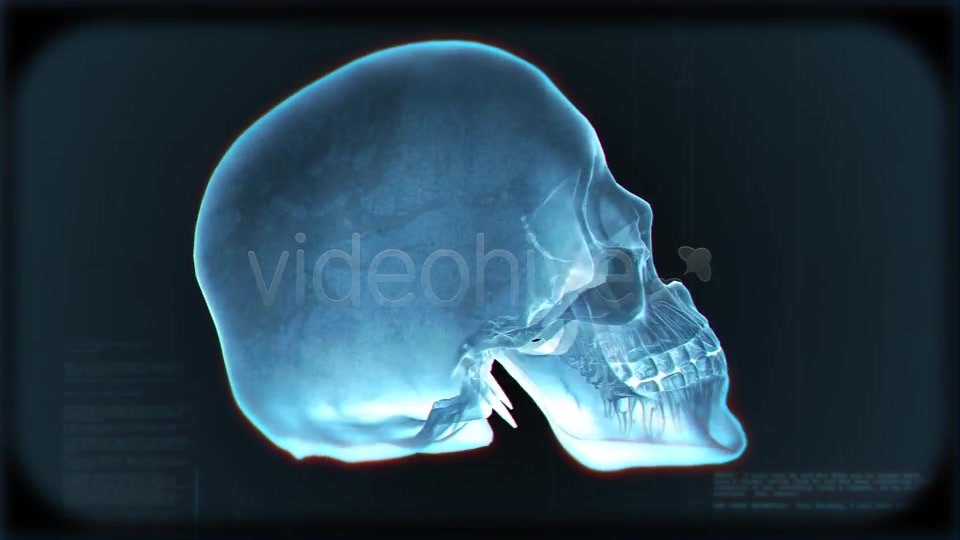 Skull Loop Pack Videohive 5228930 Motion Graphics Image 3