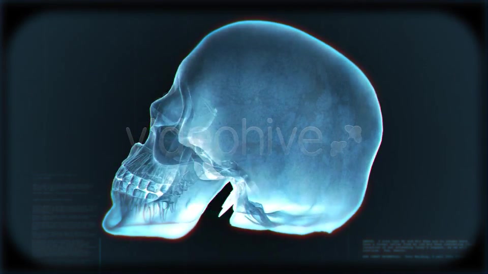 Skull Loop Pack Videohive 5228930 Motion Graphics Image 4
