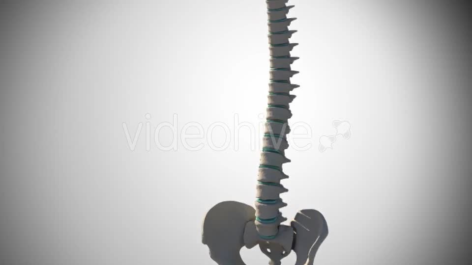 Slipped Disc Videohive 14926997 Motion Graphics Image 1