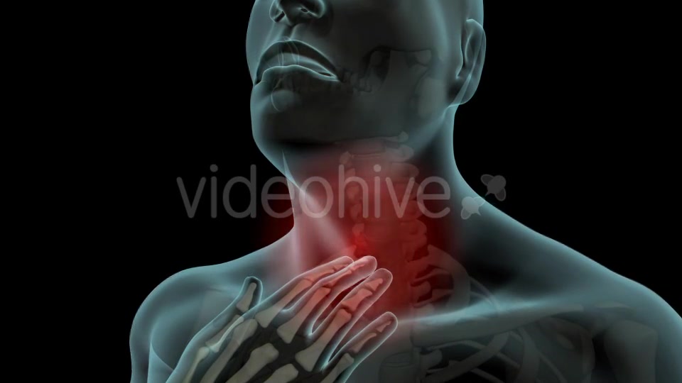 Sore Throat Videohive 21336906 Motion Graphics Image 6