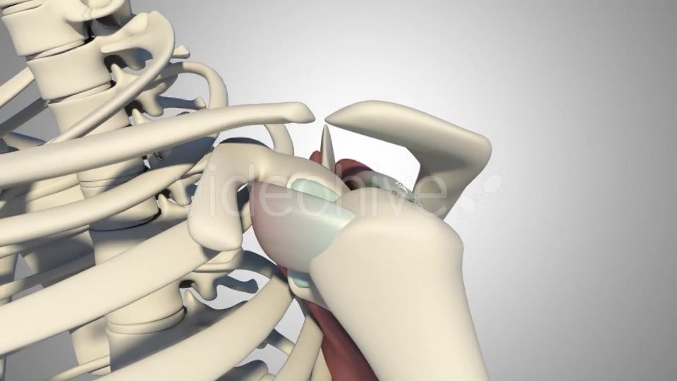 Surgical Treatment For The Rotator Cuff Tear Videohive 20535545 Motion Graphics Image 13
