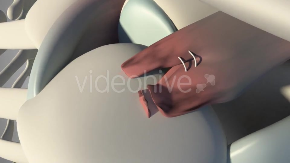 Surgical Treatment For The Rotator Cuff Tear Videohive 20535545 Motion Graphics Image 6