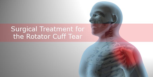 Surgical Treatment For The Rotator Cuff Tear - Videohive Download 20535545