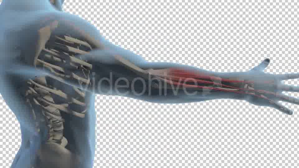 Tennis Elbow Videohive 19250201 Motion Graphics Image 11