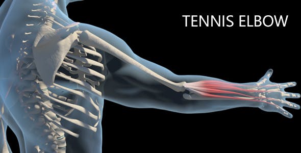 Tennis Elbow - Download 19250201 Videohive