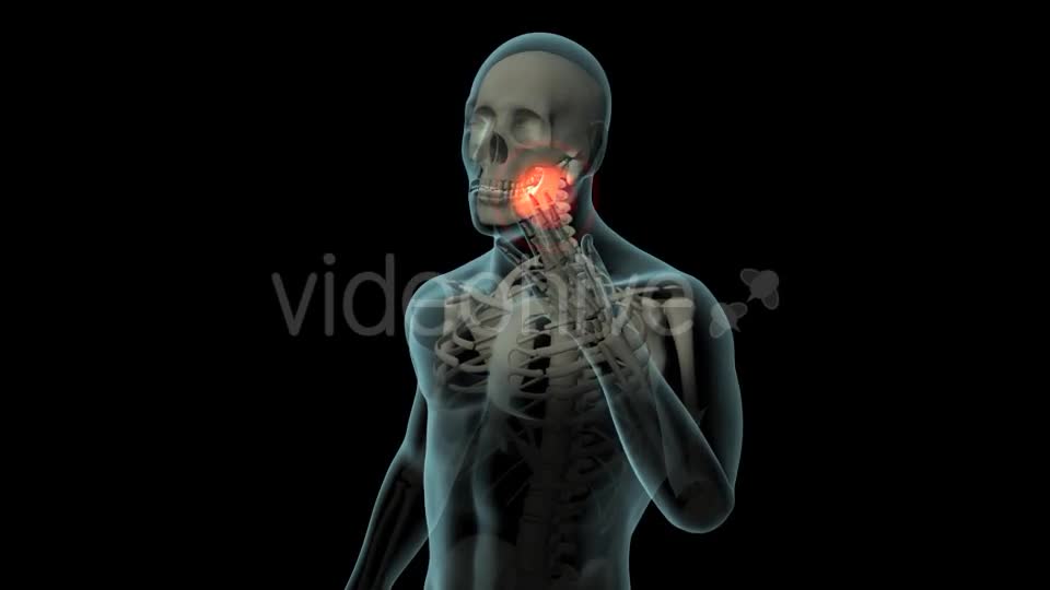 Toothache Videohive 21271027 Motion Graphics Image 1
