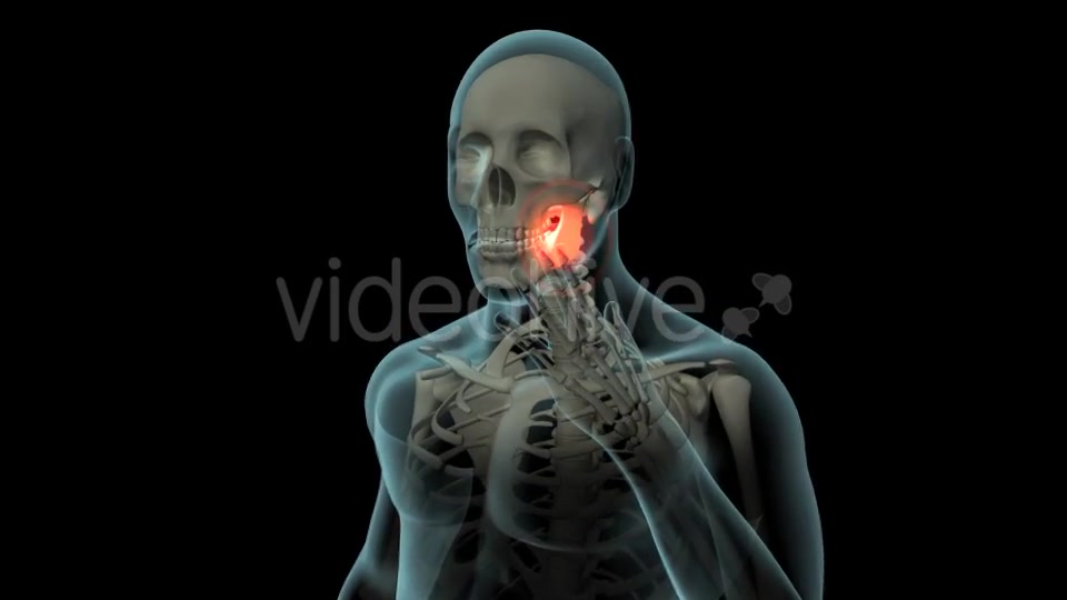 Toothache Videohive 21271027 Motion Graphics Image 3