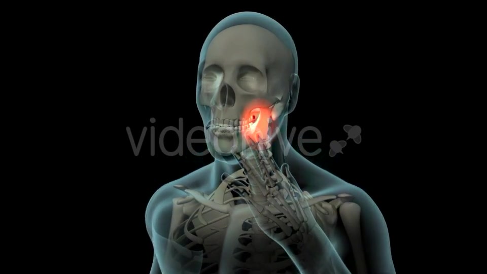 Toothache Videohive 21271027 Motion Graphics Image 4